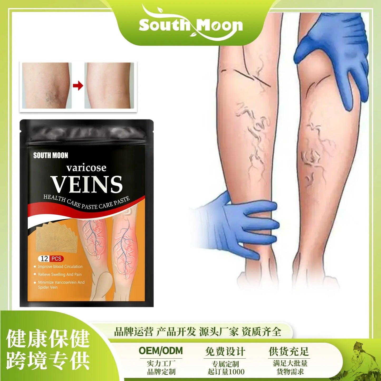 Venous health patch relieves varicose blood vessel blockage and protrusions in the feet. Cold compress venous health patch eprolo