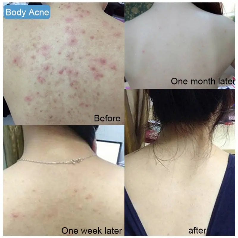 Sea Salt Soap Natural Advanced Wash Skin Whitening Soap Face Wash Hair Care Bath Acarus killing Skin Care Moisturizing Soap eprolo