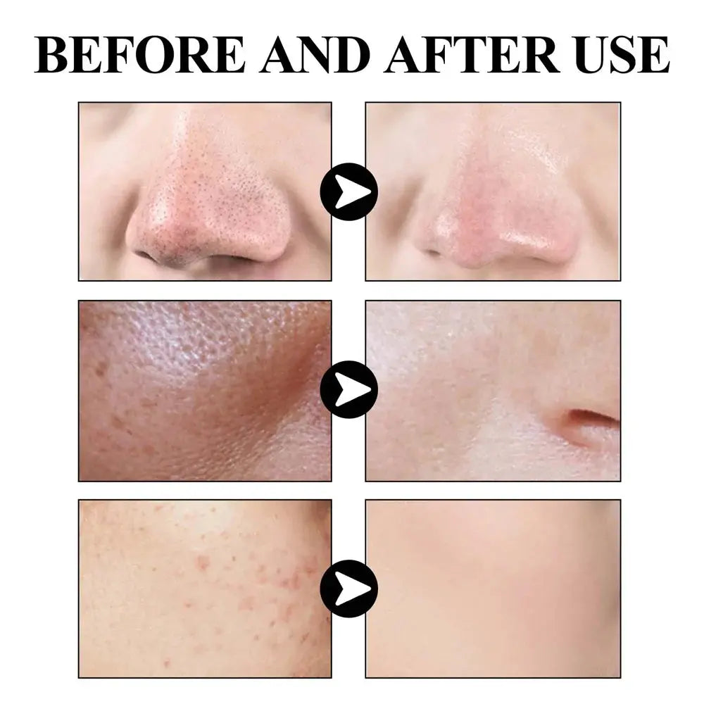 West & Month Blackhead Remove Solid Mud Film Refreshing Skin Cleaning Face Mask Moisturize Control Oil Shrink Pores Skin Care eprolo