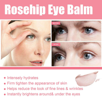 Women Extra Renewing Rosehip Eye Balm For Face Lifting Moisturizing Balm Stick Deep Hydration Moisturizer Eye Care eprolo